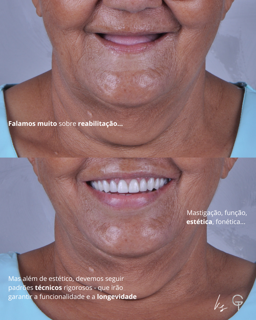 Reabilitação completa
