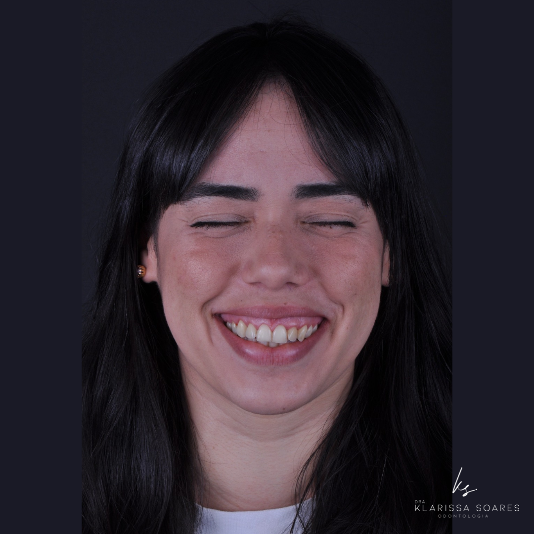 Retrato de sorriso natural